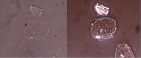 Phase Contrast Imaging