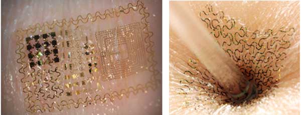 The circuits’ filamentary serpentine shape allows them to bend, twist, scrunch and stretch while maintaining functionality.