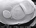 Flap (right) and disk of corneal material (left) removed from a pig’s eye in a procedure performed entirely with an excimer laser (image courtesy of Center for Ultrafast Optical Science, University of Michigan. http://www.eecs.umich.edu/USL/).