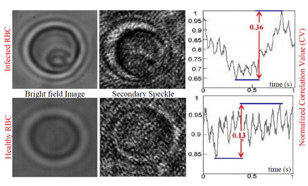 fig3-The first row shows an infected red blood cell in which a trophozoite (one stage of the life cycle the parasite responsible for malaria) can be observed, and the second row shows a healthy red blood cell. 