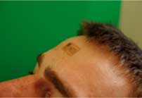 electronic tattoo applied to the forehead to measure electrical activity along the scalp.