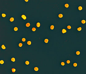 Gold Nanoparticles