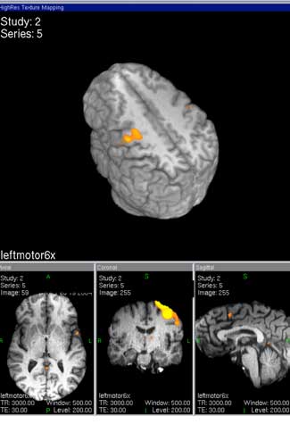 images of neuralactivity