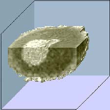 microscopic MRI image shows surprising detail in a Xenopus oocyte (a frog egg cell), including structure in the light gray cell nucleus. (Image courtesy of the Pacific Northwest National Laboratory, Biomolecular Systems Initiative).