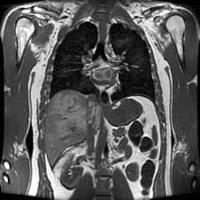 This MRI cross section of an abdomen is one of thousands of images in the The Visible Human Project database that provide a highly detailed survey of the human body.