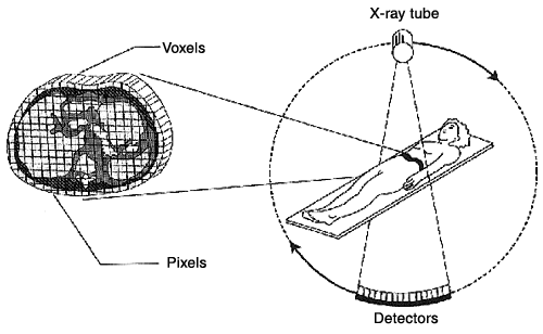 The geometry of the CT Scan; the x-ray tube and detectors rotate, with the axis of rotation running from the patient's head to toe. (image courtesy of the Mayo Clinic)