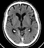 A present-day scan, showing the six-fold increase in detail