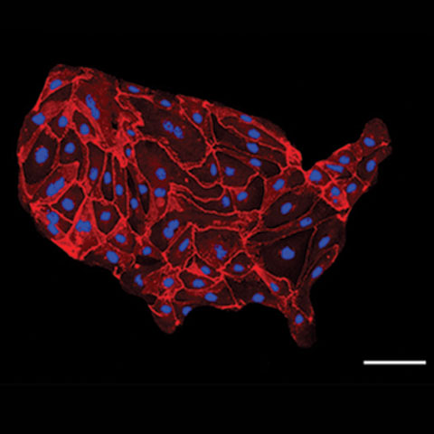 American Patterned Cells