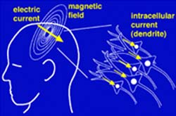 Explanation of Electrial Signals in the brain