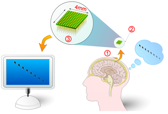 Electronic brain interfaces allow people to interact directly with computers, in a rudimentary way, via their thoughts