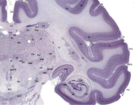 A cross-section of a primate brain, with the cerebral cortex clearly visible as an outer, darkened layer.